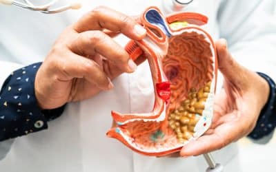 Stomach Acid Relief: How to Soothe Burning Sensations Quickly